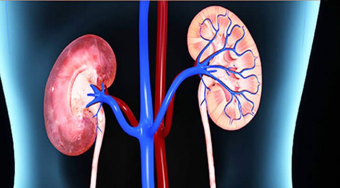 kidney transplant process